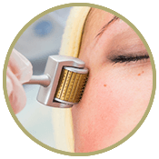 Stukje van het gezicht waarop een derma roller wordt gebruikt Stukje van het gezicht waarop een derma roller wordt gebruikt