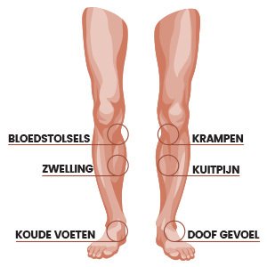 Tekening van twee benen met cirkels bij probleempunten bloedstoltes, krampen, zwelling, koude voeten, kuitpijn en doof gevoel Tekening van twee benen met cirkels bij probleempunten bloedstoltes, krampen, zwelling, koude voeten, kuitpijn en doof gevoel